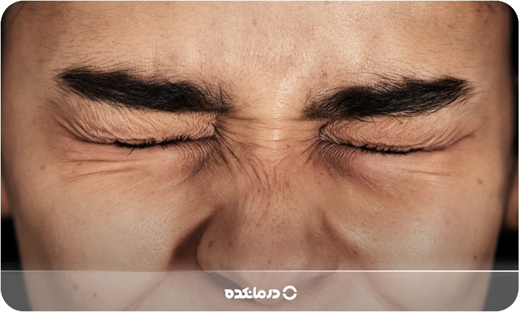 تصویر فردی که به دلیل درد یا سوزش چشمهایش را با فشار بسته را می بینید