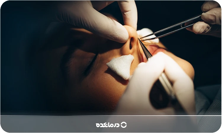 تصویر جراحی در حال عمل بینی را می بینید