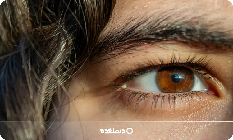 تصویر واقعی از عنبیه قهوهای را می بینید