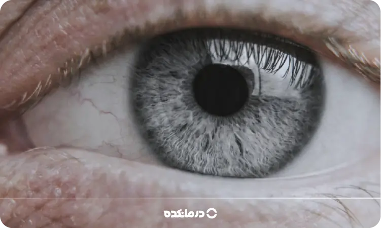 تصویری از عنبیه چشم انسان به رنگ خاکستری را می بینید