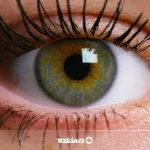 عنبیه چشم کجاست و کار آن چیست؟ عکس واقعی + ۴ نوع بیماری