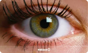 عنبیه چشم کجاست و کار آن چیست؟ عکس واقعی + ۴ نوع بیماری