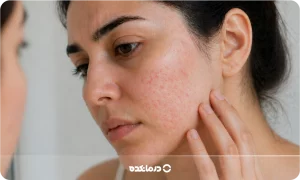 راش پوستی چیست؟ ۲۴ علت، انواع، روش درمان + بهترین پماد