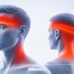 سردرد تنشی چیست؟ + علل، علائم، روشهای پیشگیری و درمان