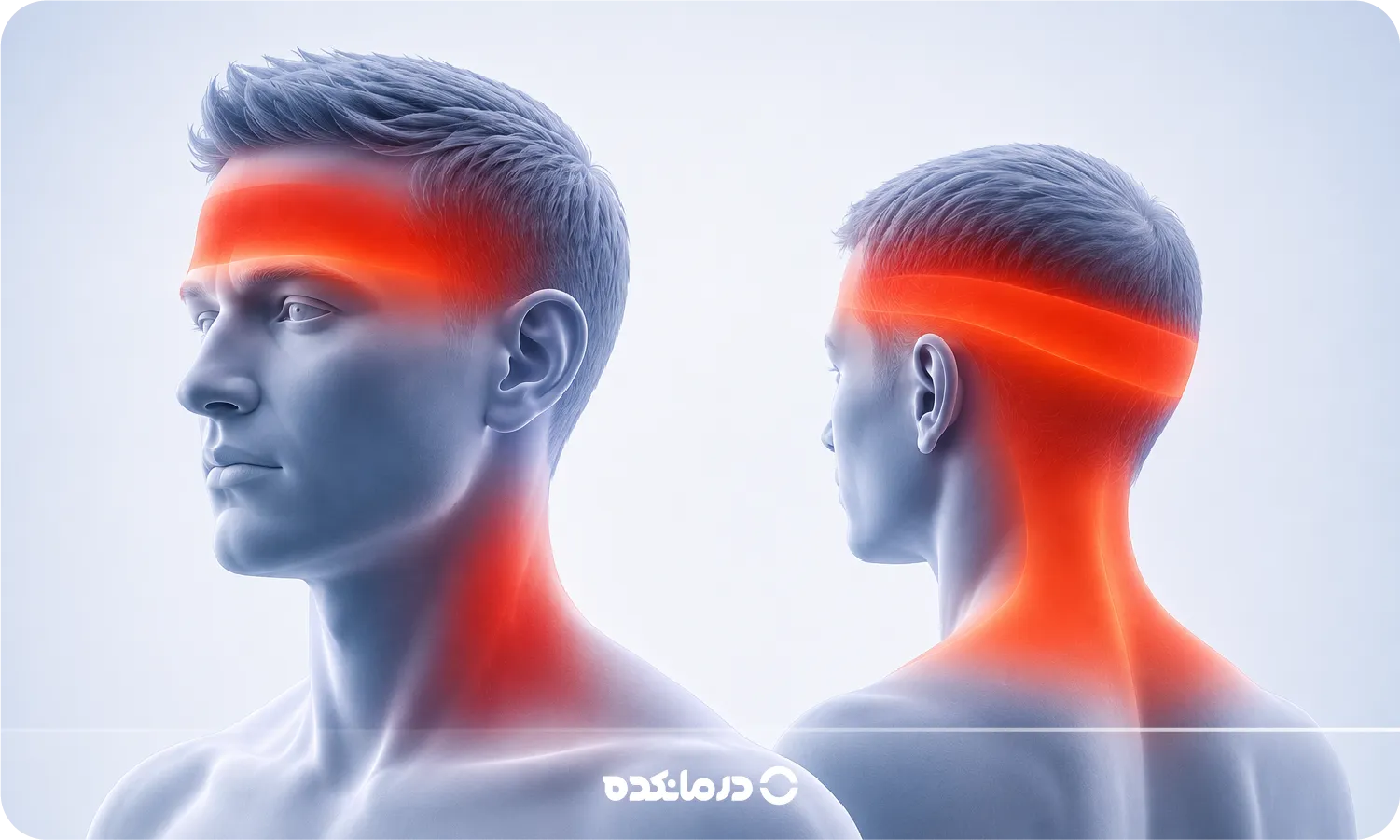 سردرد تنشی چیست؟ + علل، علائم، روش‌های پیشگیری و درمان