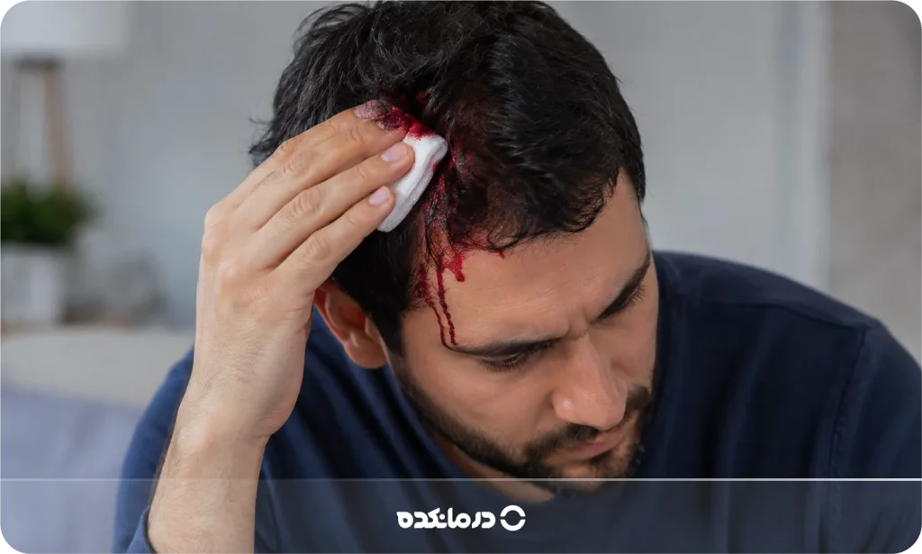 تصویر فردی که به سرش ضربه خورده و خونریزی دارد را می بینید