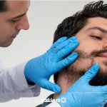 کاشت ریش و سبیل [۴ روش، عوارض، دوره نقاهت + بهترین سن]