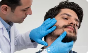 کاشت ریش و سبیل [۴ روش، عوارض، دوره نقاهت + بهترین سن]