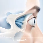 بیرون زدگی چشم از حدقه (پروپتوز) [۷ علت، علائم + درمان]