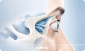 بیرون زدگی چشم از حدقه (پروپتوز) [۷ علت، علائم + درمان]