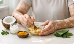 درمان خانگی پیسی با ترکیبات طبیعی؛ معرفی ۱۴ راه‌کار ساده برای بهبود وضعیت پوست