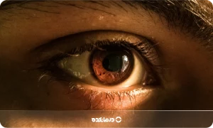 مردمک چشم کجاست و کار آن چیست؟ [عکس + ۹ نوع بیماری]