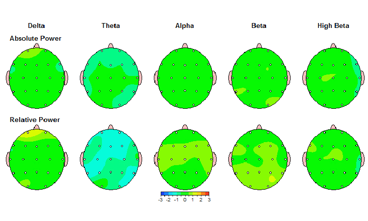 تصویر QEEG فرد سالم را می بینید