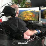 بیماری ALS اسکلروز جانبی آمیوتروفیک؛ علت، علائم + درمان