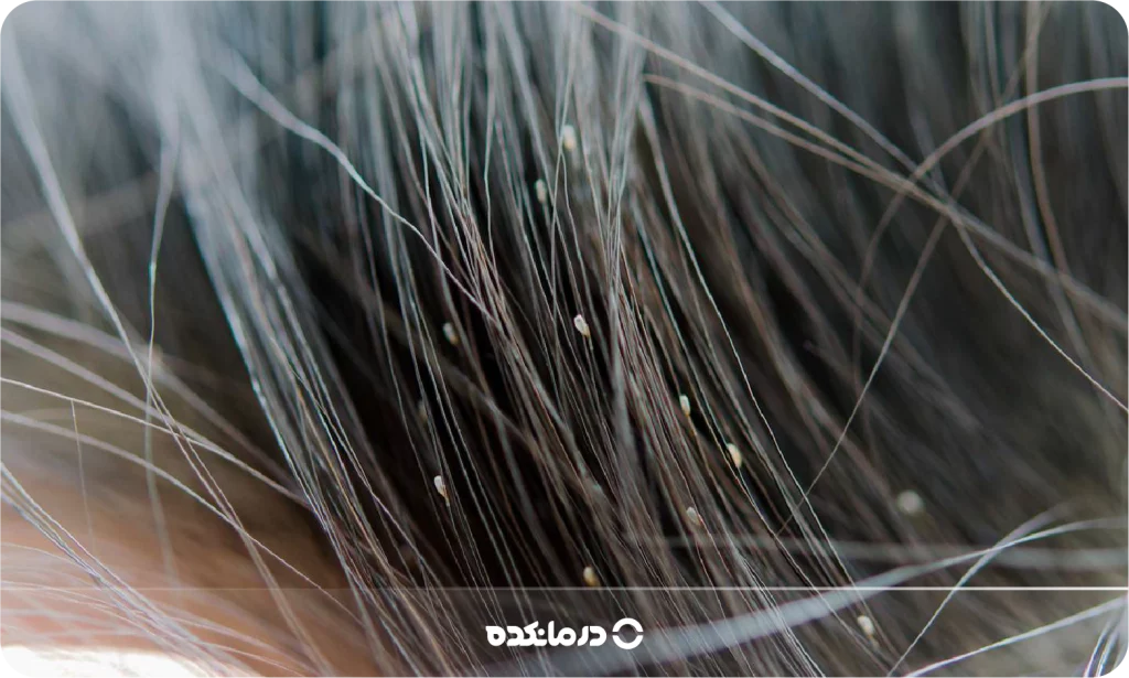 تصویر شپش را می بینید