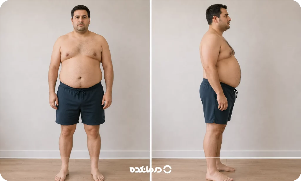 تصویر فردی با تیپ بدنی اندومورف را می بینید