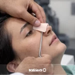 اسپلینت بینی [عکس و مزایا + نحوه گذاشتن و زمان برداشتن]