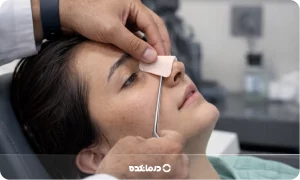 اسپلینت بینی [عکس و مزایا + نحوه گذاشتن و زمان برداشتن]