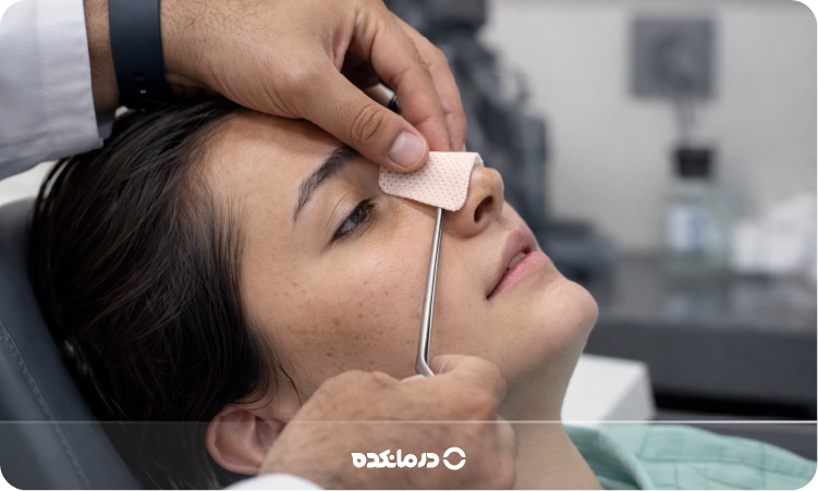 اسپلینت بینی [عکس و مزایا + نحوه گذاشتن و زمان برداشتن]