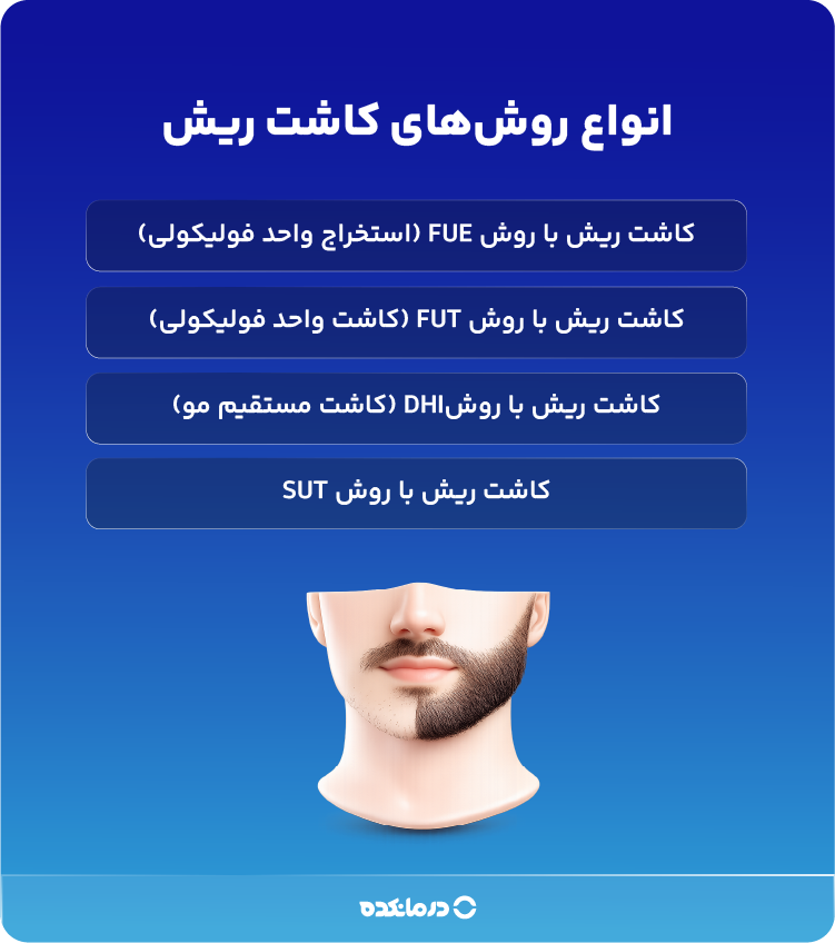 اینفوگرافی انواع روش های کاشت ریش