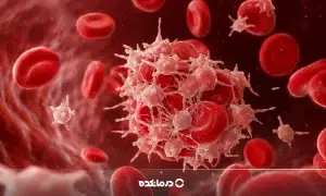 پایین بودن پلاکت خون نشانه سرطان است؟ بررسی رابطه پلاکت پایین با سرطان