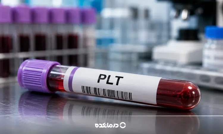 تصویر لوله آزمایشگاه حاوی خون و برچسب آزمایش PLT را می بینید