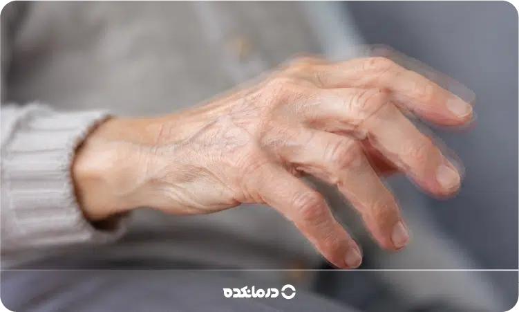 تصویر بیمار مبتلا به لرزش دست را می بینید