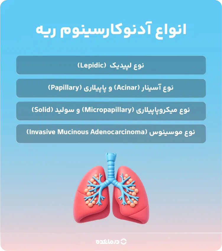 اینفوگرافی انواع آدنوکارسینوم ریه