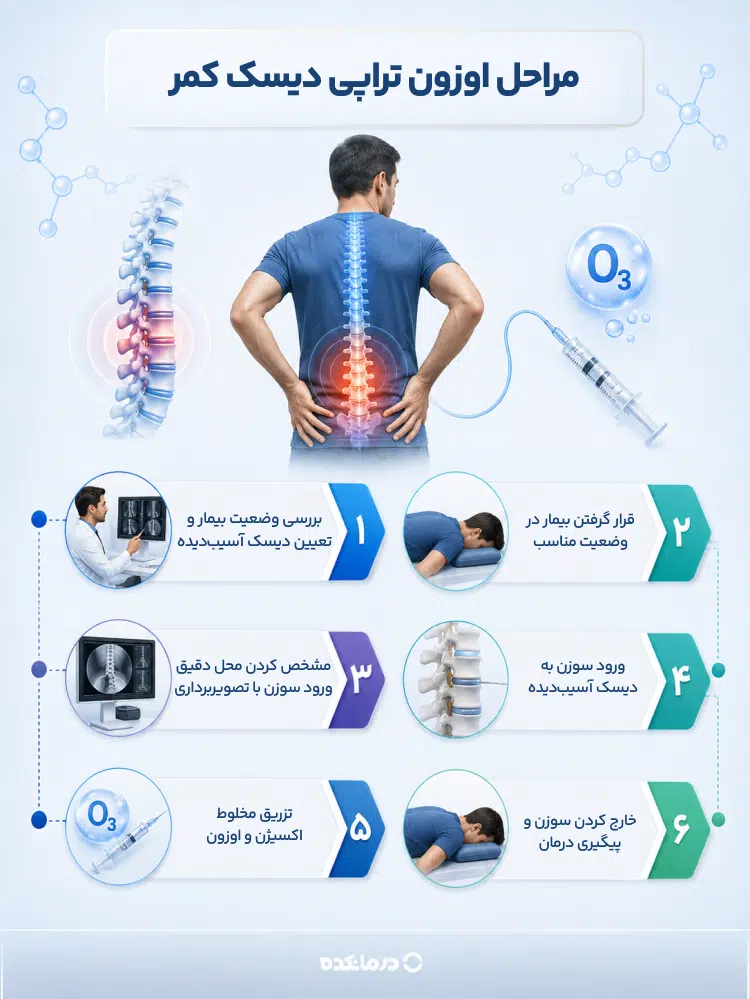 اینفوگرافی مراحل اوزون تراپی دیسک کمر را می بینید