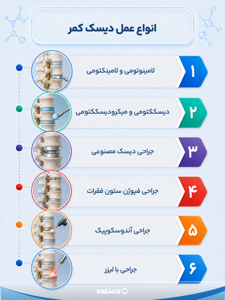 اینفوگرافی «انواع عمل دیسک کمر»