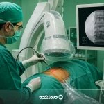 عمل لیزری دیسک کمر چیست؟ مزایا، عوارض و روش انجام جراحی دیسک با لیزر