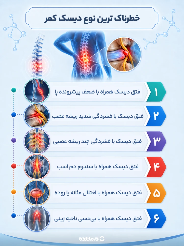 اینفوگرافی خطرناک ترین نوع دیسک کمر