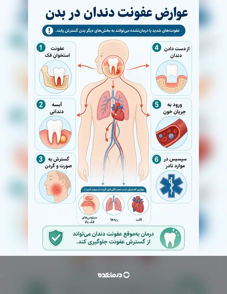 اینفوگرافیک عوارض احتمالی عفونت دندان