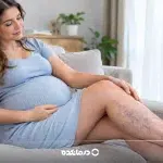 واریس پا در بارداری؛ علائم و خطرات آن چیست و برای درمان چه کار کنیم؟