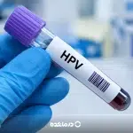 آزمایش HPV چگونه انجام می شود؟ روش انجام در مردان و زنان و تفسیر جواب