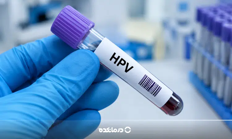 آزمایش HPV چگونه انجام می شود؟ روش انجام در مردان و زنان و تفسیر جواب