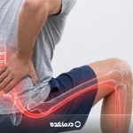 درد سیاتیک چقدر طول میکشد؟ چند روز درد طبیعی است و چرا طولانی میشود؟