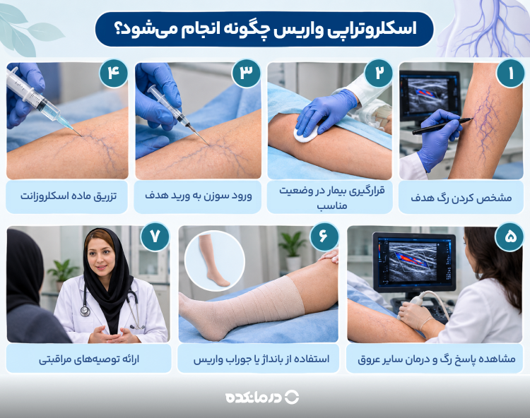 اینفوگرافی انجام اسکلروتراپی واریس پا را می بینید
