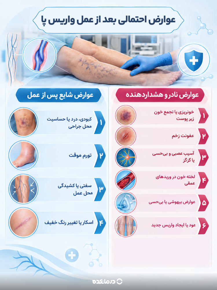 اینفوگرافی عوارض احتمالی بعد از عمل واریس پا