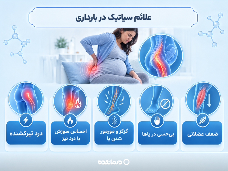 اینفوگرافی علائم سیاتیک در بارداری (درد تیرکشنده، احساس سوزش یا درد تیز، گزگز و مورمور شدن پا، بی‌حسی در پاها، ضعف عضلانی)